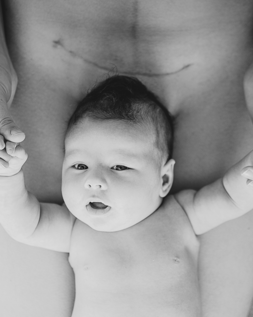 Embracing Your Postpartum Journey: Navigating Cesarean Births with Confidence and Care