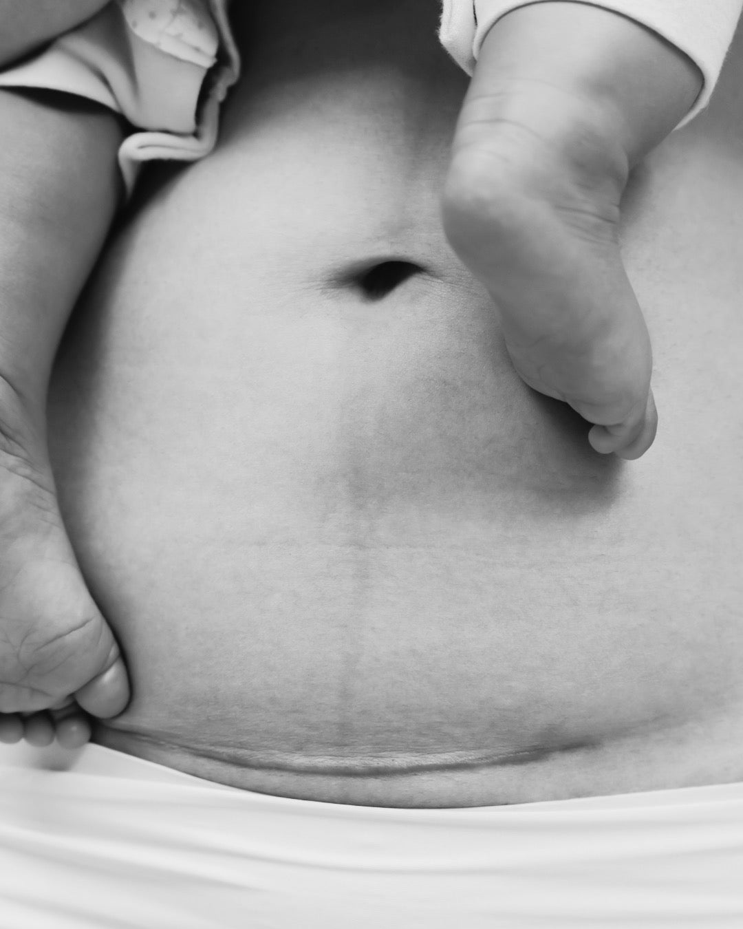 Honoring Cesarean Births: Strength in Every Story
